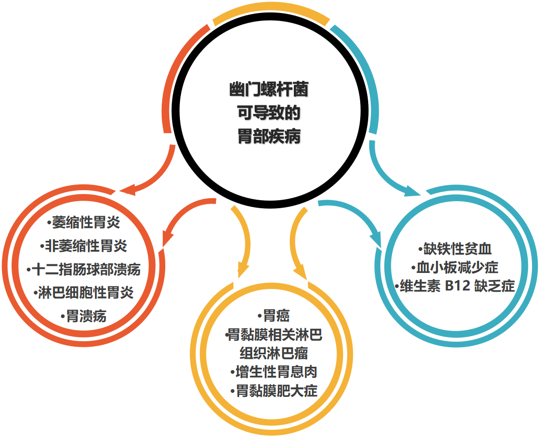 幽门螺杆菌的最新治疗方法