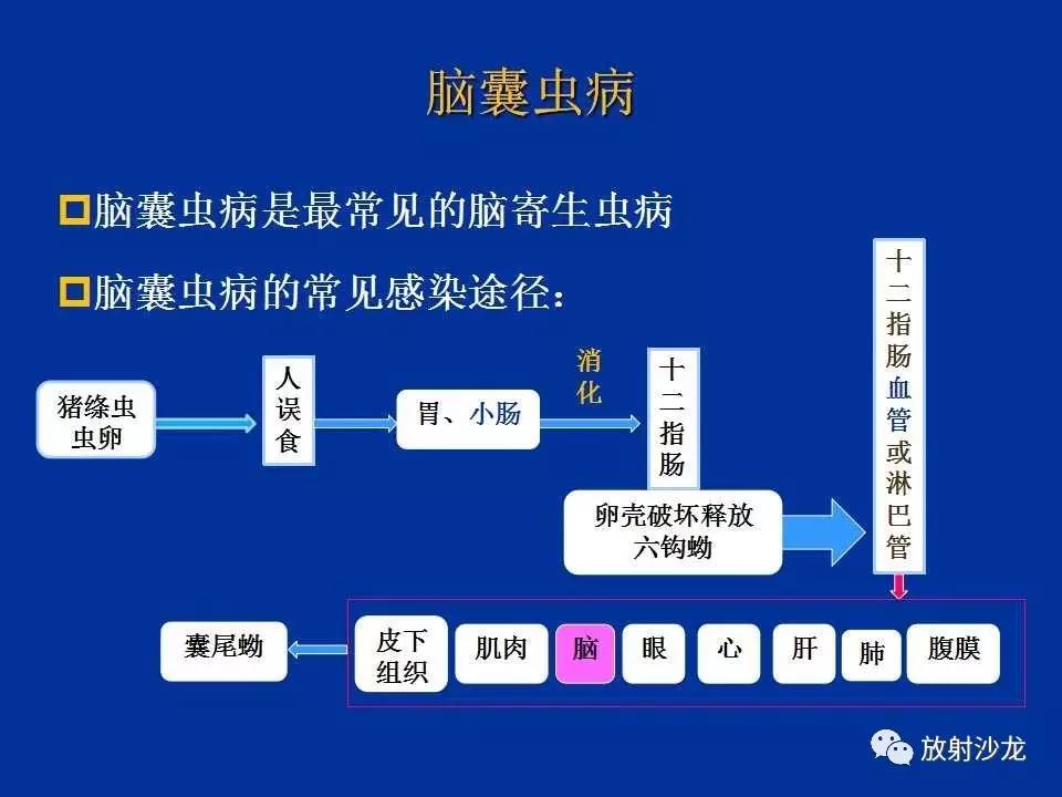 最新幼虫囊状病药物治疗进展